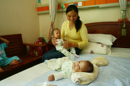 Conjoined twins separated and healthy