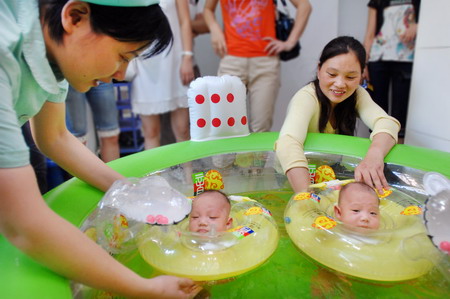Conjoined twins separated and healthy