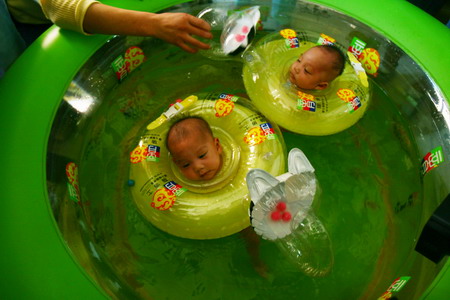 Conjoined twins separated and healthy