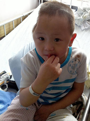 Boy accuses stepmom of head injury