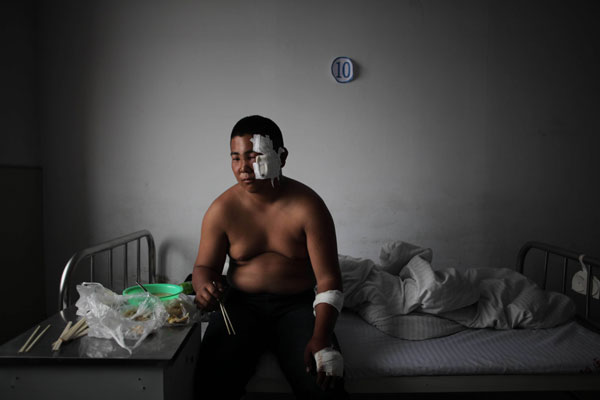 Jiao Jinming, 18, is recovering from his injuries at Fuyang hospital in Dehui city, Jilin province. Families cling to fading hopes of finding survivors