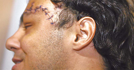 Injured Massa arrives in Brazil for more tests