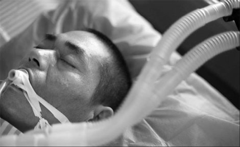 Illegal brick kiln worker struggles for life in hospital