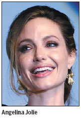 Experts cautious over celebrity's surgery