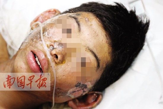 廣西:迎親車上20余萬響鞭炮被引燃 5人被炸傷(圖)