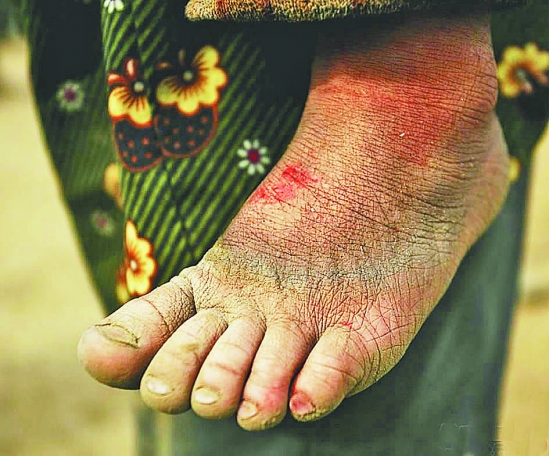 新昌：寒冬里的磚窯“花朵”