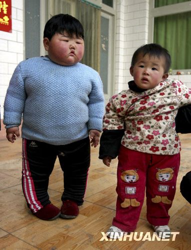 山西2歲胖丫重達41.5公斤 需及時對癥治療(圖)