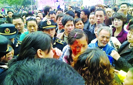 女城管“輕輕一揮”對講機 小販縫6針