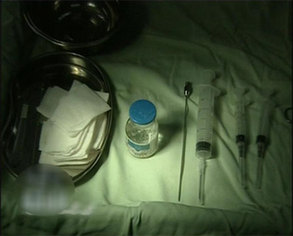 部分消費者美容整形注射奧美定引發癌癥