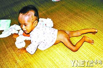 8個月嬰兒被母親遺棄在家 餓8天瘦成皮包骨