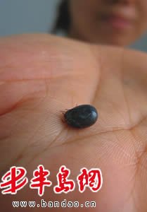 河南回應蜱蟲叮咬人致死:3年共發現245例