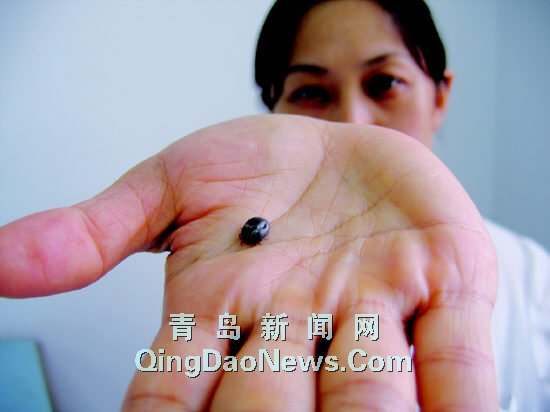 衛生部發布“蜱的特點及預防控制知識”