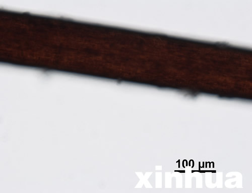 神農(nóng)架首次公布不明動(dòng)物毛發(fā)顯微照
