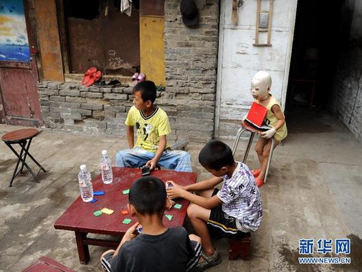 備受網(wǎng)友關(guān)注的“面具娃娃”回家休養(yǎng)