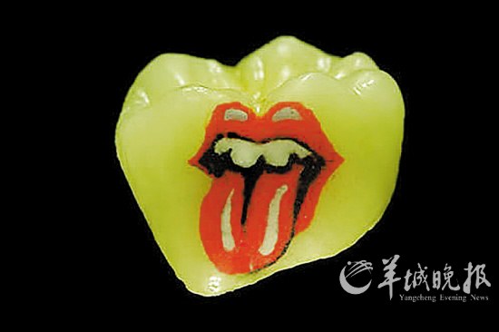 給牙齒做“文身”