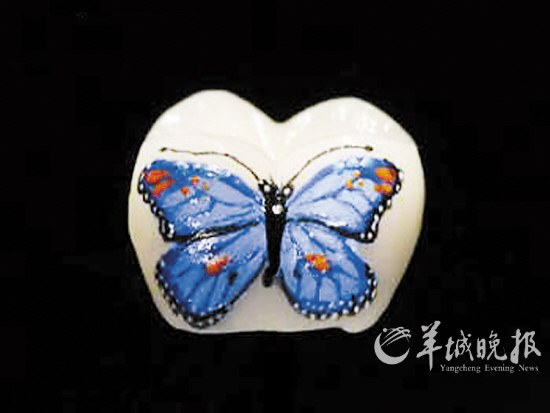 給牙齒做“文身”