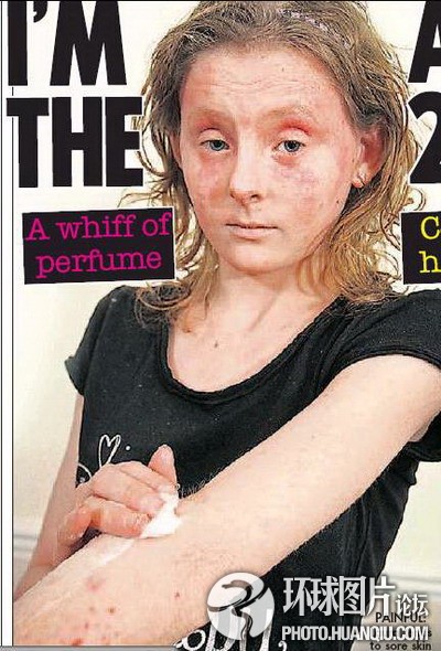 難以置信的罕見怪病：忘記呼吸 靜電過敏 聽鬧鐘響心臟停跳