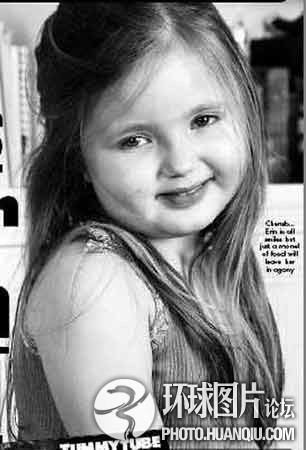 難以置信的罕見怪病：忘記呼吸 靜電過敏 聽鬧鐘響心臟停跳