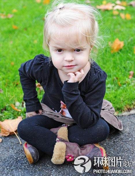 難以置信的罕見怪病:忘記呼吸 靜電過敏 聽鬧鐘響心臟停跳