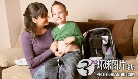 難以置信的罕見怪病：忘記呼吸 靜電過敏 聽鬧鐘響心臟停跳