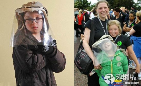 難以置信的罕見怪病：忘記呼吸 靜電過敏 聽鬧鐘響心臟停跳