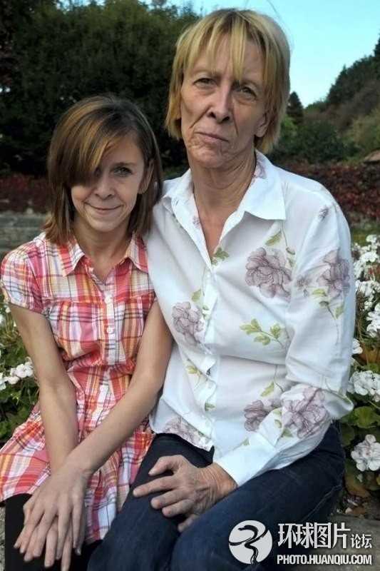 難以置信的罕見(jiàn)怪病:忘記呼吸 靜電過(guò)敏 聽(tīng)鬧鐘響心臟停跳