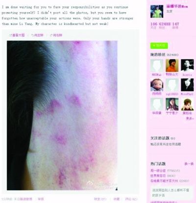 李陽再次家暴!妻子曝光照片