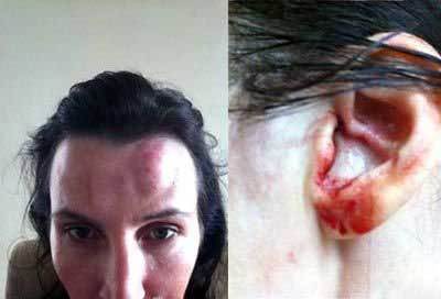 李陽再次家暴！妻子曝光照片