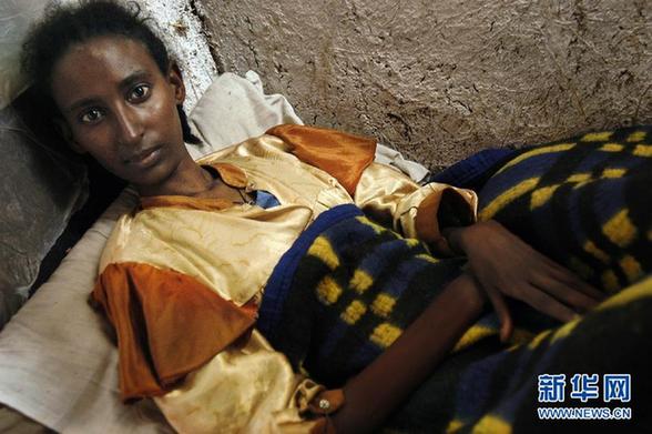 世界艾滋病日：關“艾”，從擁抱開始