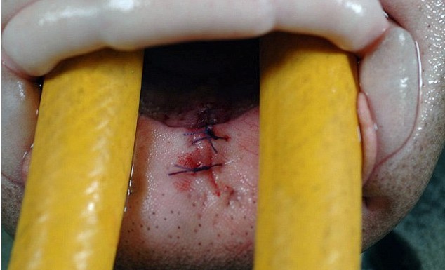 手術后遺癥？世界上第一條素食鯊魚愛吃芹菜