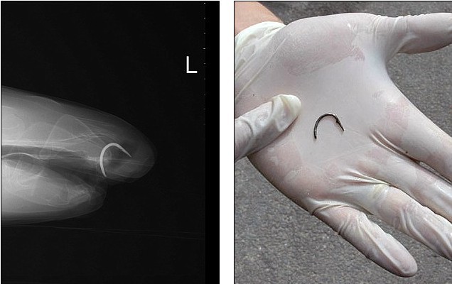 手術后遺癥？世界上第一條素食鯊魚愛吃芹菜