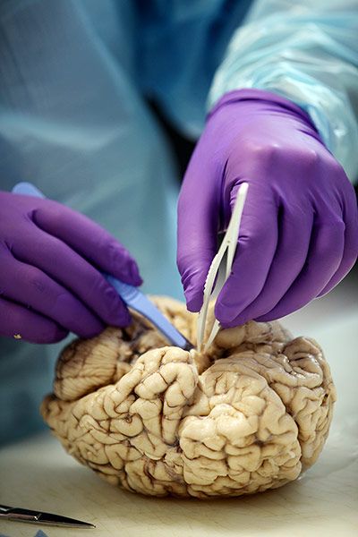 揭秘大腦解剖全過(guò)程