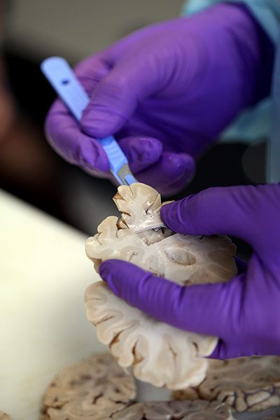 揭秘大腦解剖全過(guò)程