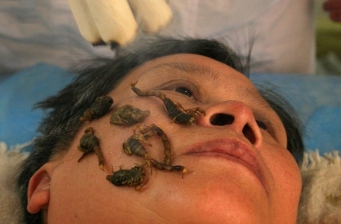 令人瞠目結(jié)舌的全球另類(lèi)療法