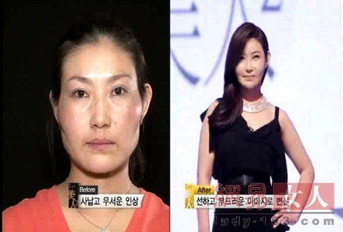 丑女變靚妹！韓國整容節目爆紅