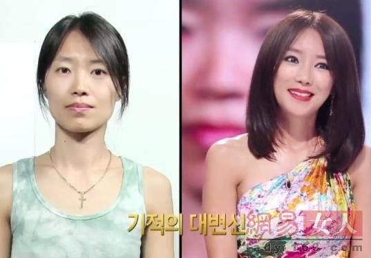 丑女變靚妹！韓國整容節目爆紅