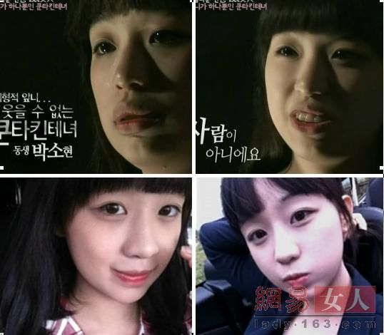 丑女變靚妹！韓國整容節目爆紅