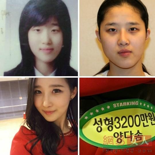 丑女變靚妹！韓國整容節(jié)目爆紅