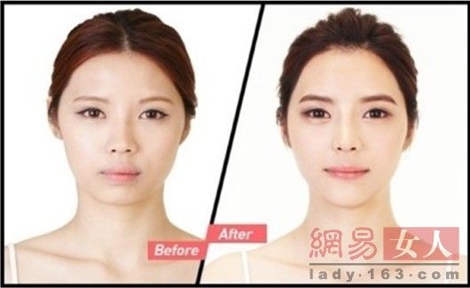 丑女變靚妹！韓國整容節目爆紅