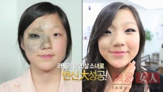 丑女變靚妹！韓國(guó)整容節(jié)目爆紅