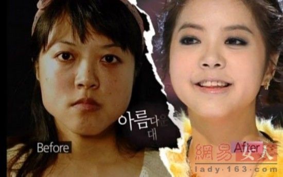 丑女變靚妹！韓國整容節目爆紅