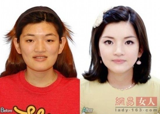 丑女變靚妹！韓國整容節目爆紅