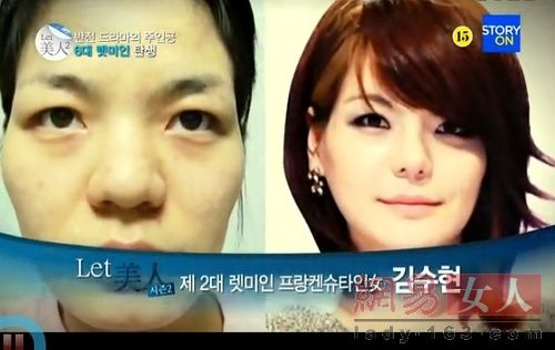 丑女變靚妹！韓國(guó)整容節(jié)目爆紅