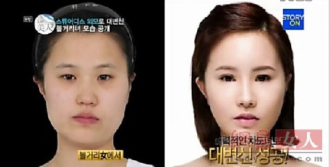 丑女變靚妹！韓國(guó)整容節(jié)目爆紅