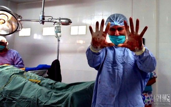 探秘國外令人觸目驚心的廉價(jià)整容