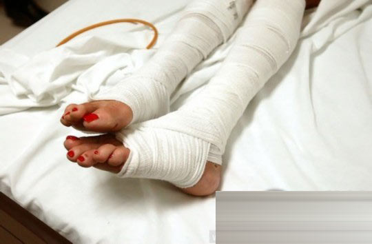 探秘國外令人觸目驚心的廉價整容