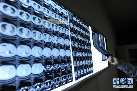 病前一周接觸過(guò)禽類者為感染H7N9高危人群