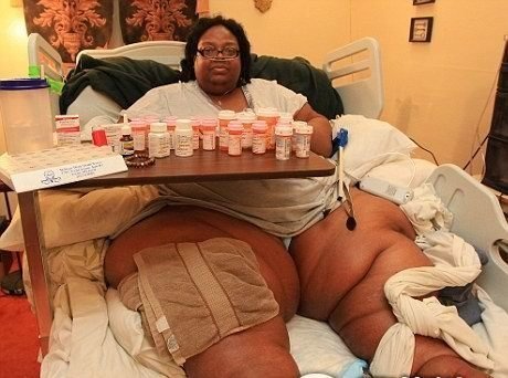 盤點全球令人無法想象的胖人