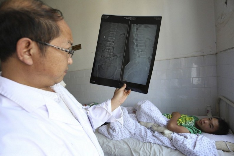 云南普洱一中學演講時大樹倒塌致1死28傷