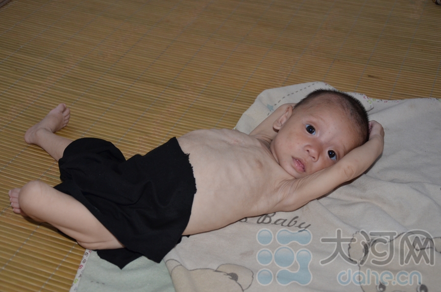 饑餓娃娃愛心賬戶開通 全國合力不讓悲劇再重演(圖)